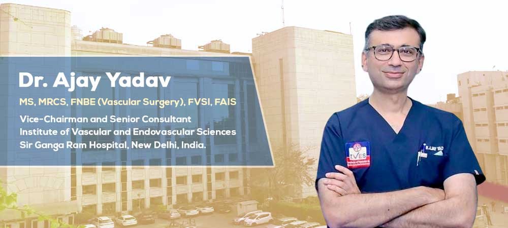 dr-ajay-yadav-vascular-surgeon-in-india
